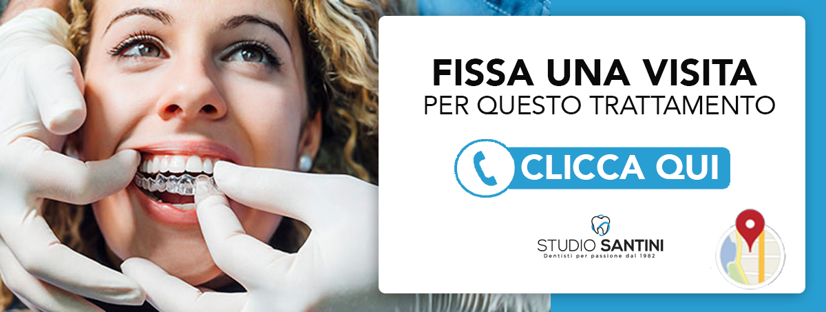 Invisalign Roma Nord